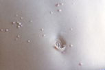 Imagen ilustrativa del artículo Tratamiento del molusco contagioso (con fotos)